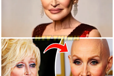 Dolly Parton Reveals Why She Wears Wigs, Now She is Out in the Open