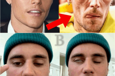 🚨 The Justin Bieber Situation Just Took a DARK Turn — What Just Happened Has Fans SHOCKED 😱💔