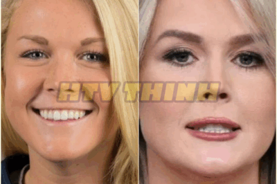 Karoline Leavitt “I want Michael Jackson’s nose” Plastic surgeon: “I got you covered!”