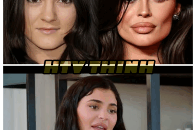 Kylie Jenner Admits She Was ‘Insecure About My Lips’ & Reveals Whether She’d Get Plastic Surgery