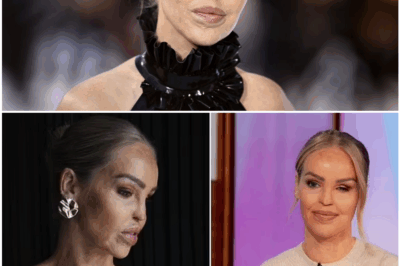 💥 Scarred But Unstoppable: Katie Piper Turns 40 and Drops BOMBSHELLS About Beauty, Ageism & Survival 😢👊