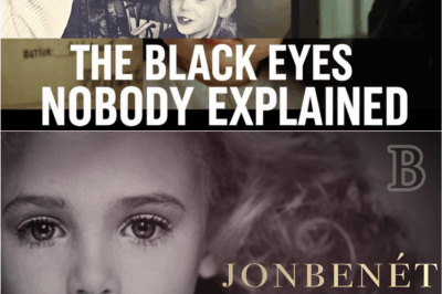 🕵️‍♀️ JonBenét’s Final Hours: The Chilling Truth Behind Those Black Eyes and Bruises That Defied Every Story Told 💔