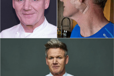 🔥 Gordon Ramsay’s Most Terrifying Battle Yet: The Celebrity Chef Confronts Skin Cancer With Raw Confession 🍴