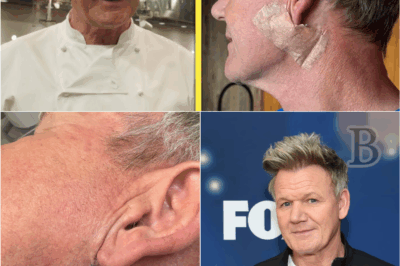 🚨 “It Could’ve Been Too Late”: Gordon Ramsay Opens Up About Skin Cancer Diagnosis — And the Photo That Made Him See a Doctor 📸🧴