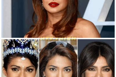 Priyanka Chopra Jonas Confesses: A Nose Surgery That Almost Destroyed Her Life 😱💔