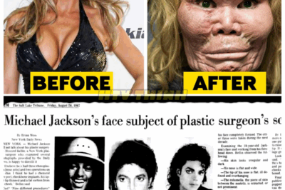 😱🎬 20 Celebrity Plastic Surgery Disasters That Shocked Fans!