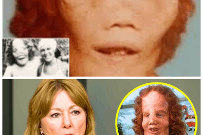 🐘 The Final, Heartbreaking Words From Rocky Dennis’s Mom Before She Died—A Revelation That Turns the Tragic Story Upside Down! ⚡ Her last confession exposes unsettling truths about Rocky Dennis’s life and legacy, shaking the foundations of a story once thought to be pure inspiration. “Because sometimes, the truth is the cruelest legacy.” 👇