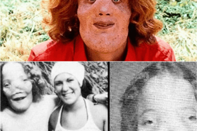 💔 He Was Called “The Boy With the Lion Face” — The Untold Agony Behind Rocky Dennis’s Mask 😢