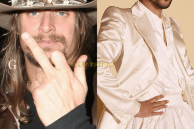 Kid Rock didn’t hold back, declaring: “You bring a man in a dress to the Super Bowl? Then don’t call it football, call it a circus.”