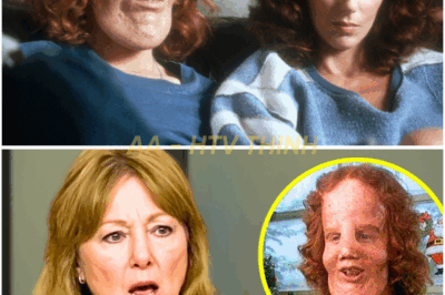 Before She Died, Rocky Dennis’s Mom FINALLY Broke Silence About Rocky Dennis And It’s Not Good