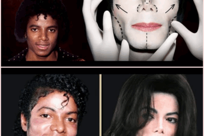 The Truth Behind Michael Jackson’s Plastic Surgery: A Deep Dive into His Transformation