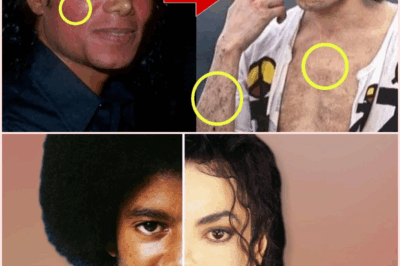 Behind the Mask: The Painful Truth About Michael Jackson’s Skin Transformation