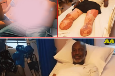 He Divorced His Wife Of 22 Yrs For His Daughter’s BF -After He Lost His Legs & Hands, She Dumped Him🥚