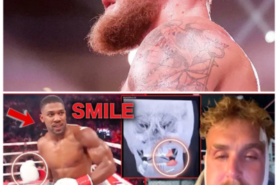 🐘 Jake Paul’s Emotional JAW SURGERY Video Gets MOCKED by MMA Fans! | Reaction Recap 💔 “Not everyone is feeling sorry for him!” In a poignant video addressing his jaw surgery, Jake Paul faces a wave of mockery from the MMA community. As fans and fighters share their reactions, we explore the dynamics of this ongoing rivalry and what it means for Paul’s image in the combat sports world. What’s next for him after this ordeal? Let’s find out! 👇