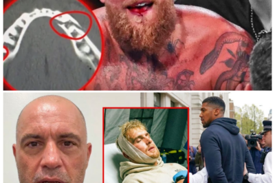 🐘 “A Dangerous Precedent!” Pros React to Joshua’s Near Knockout of Jake Paul! 💥 “When a fight turns into a near-tragedy, the implications are serious!” As Anthony Joshua came dangerously close to knocking out Jake Paul, the boxing world erupted in outrage. Industry veterans are expressing their concern over the potential consequences of such aggression, with some going as far as calling for Joshua to be jailed. What does this mean for the future of boxing and celebrity fights? Get the inside scoop on the reactions from the pros! 👇
