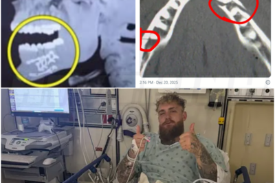 🎰 Jake Paul has jaw surgery, teeth removed following Anthony Joshua KO