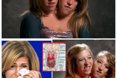 Mother Of The Conjoined Twins Confirmed The Horrible Rumors Are True