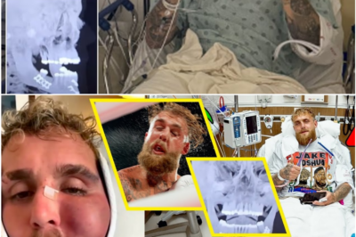 Jake Paul’s Fighting Future Thrown Into Chaos After Jaw Surgery Sparks Alarming Questions