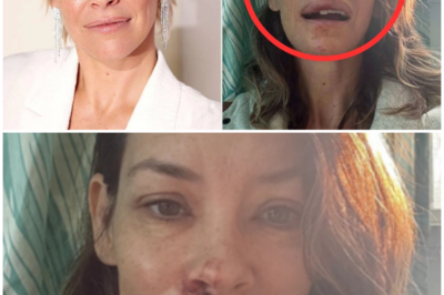😱 Evangeline Lilly Reveals Shocking Health Update: Living with Brain Damage! 😱 – HTT