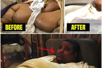 🎰 Remember This Man Who Weighed 1022 Pounds? This Is How He Looks Now!