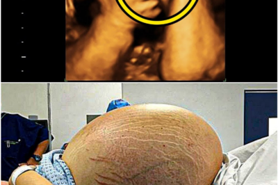 Expecting Twins, She Got the Shock of a Lifetime: The Ultrasound That Left a Doctor Speechless