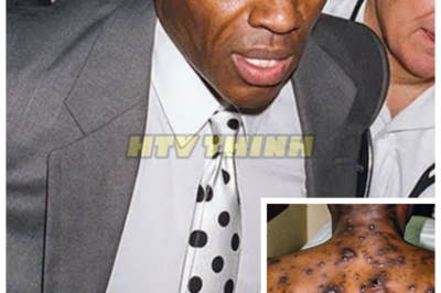 🙊 The Silent Struggles: 21 R&B Legends and Their Hidden Battles 🎤💔  In a gripping exploration of triumph and tragedy, this documentary unveils the heartbreaking stories of 21 Black R&B legends forced to step away from their illustrious music careers due to incurable diseases. These iconic artists, who shaped the sound of R&B and soul, left behind a legacy that resonates through generations, yet their personal battles remain largely untold. As we delve into their lives, we uncover the human side behind their fame, revealing the relentless health challenges that transformed their journeys. With time running out for many, the question lingers: how do we honor the legacy of these musical giants while confronting the harsh realities of their struggles? Prepare for an emotional ride that highlights the resilience of Black excellence in music and the profound cost of artistry. 👇